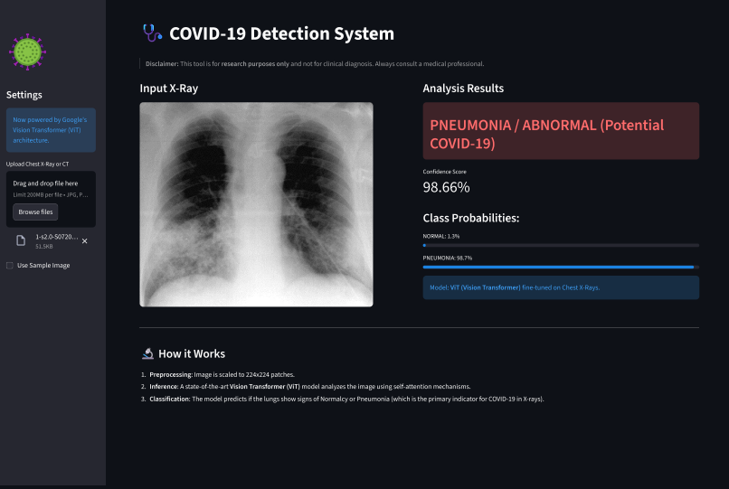 COVID-19 Detection System